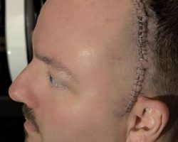 HATEBREED's WAYNE LOZINAK Is 'Getting Better Every Day' After Undergoing Operation To Remove Benign Brain Tumor